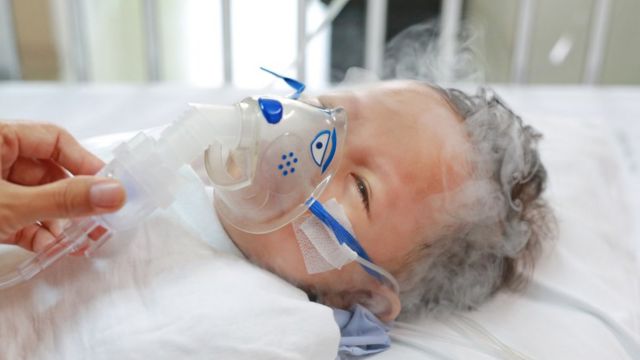 Minsal alertó "aumento significativo" de enfermos respiratorios